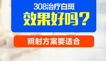 308nm准分子激光仪治白癜风怎么样