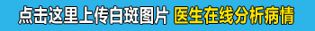 308激光治疗白癜风多久照一次