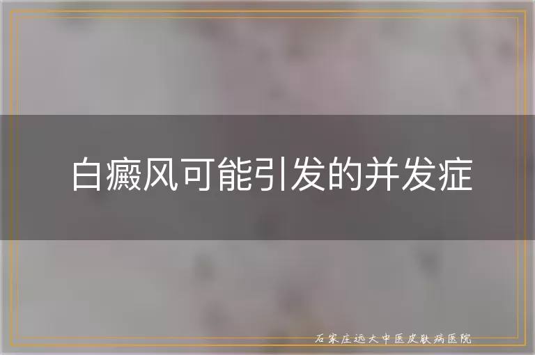 白癜风可能引发的并发症