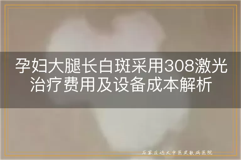 孕妇大腿长白斑采用308激光治疗费用及设备成本解析