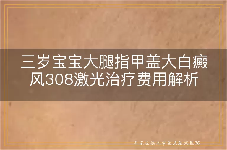 三岁宝宝大腿指甲盖大白癜风308激光治疗费用解析