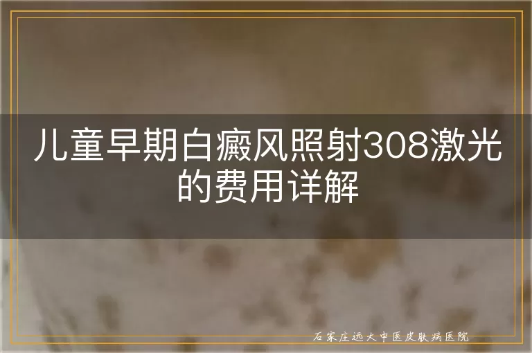 儿童早期白癜风照射308激光的费用详解