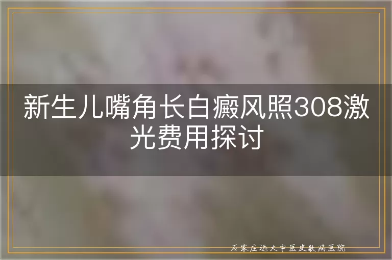 新生儿嘴角长白癜风照308激光费用探讨