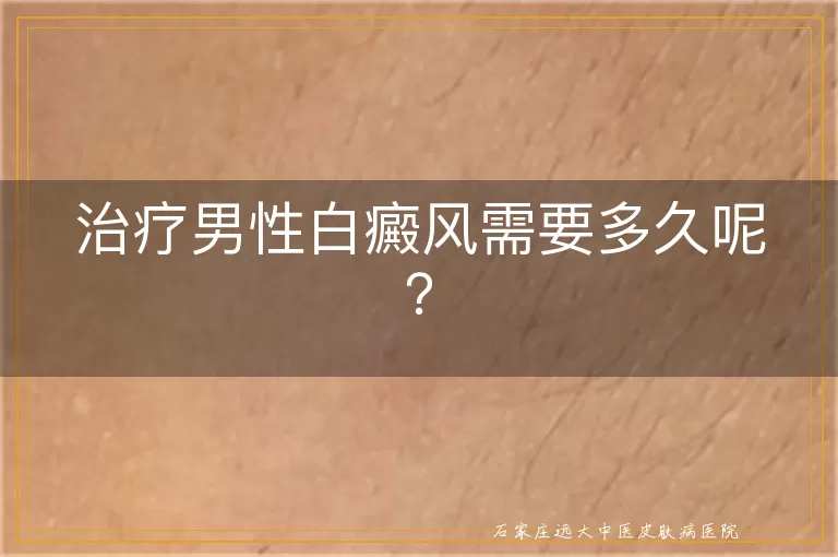 治疗男性白癜风需要多久呢？