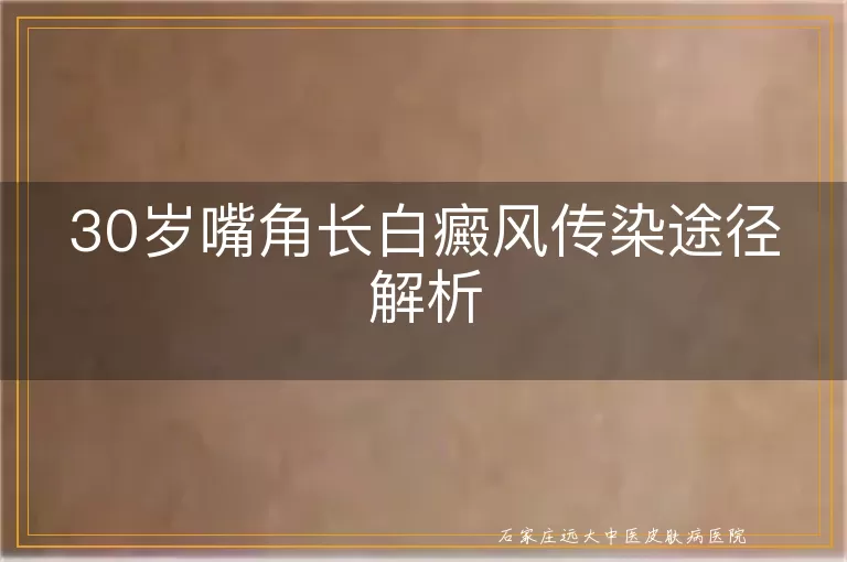 30岁嘴角长白癜风传染途径解析