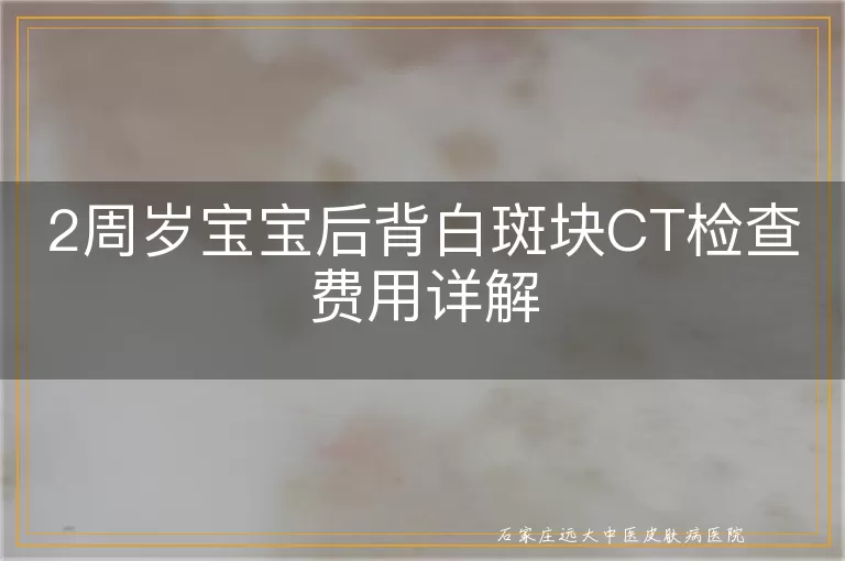 2周岁宝宝后背白斑块CT检查费用详解