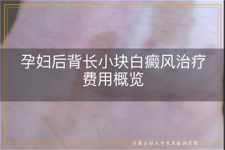 孕妇后背长小块白癜风治疗费用概览