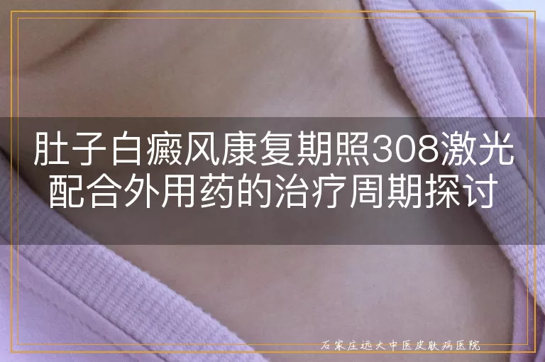 肚子白癜风康复期照308激光配合外用药的治疗周期探讨