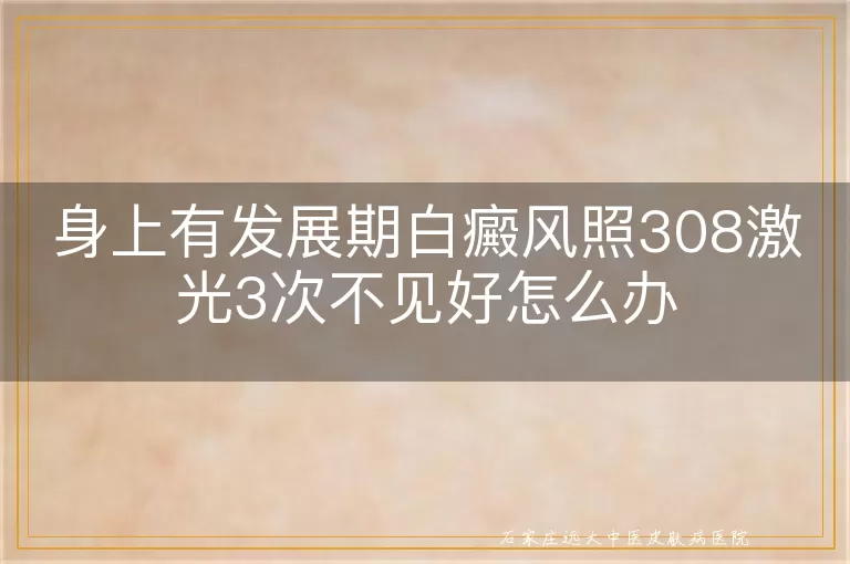 身上有发展期白癜风照308激光3次不见好怎么办