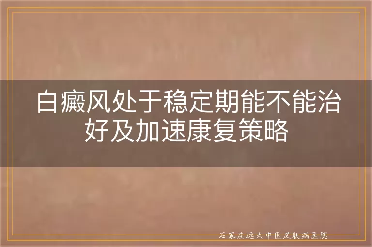 白癜风处于稳定期能不能治好及加速康复策略