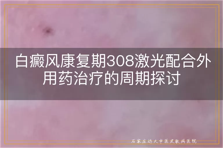 白癜风康复期308激光配合外用药治疗的周期探讨