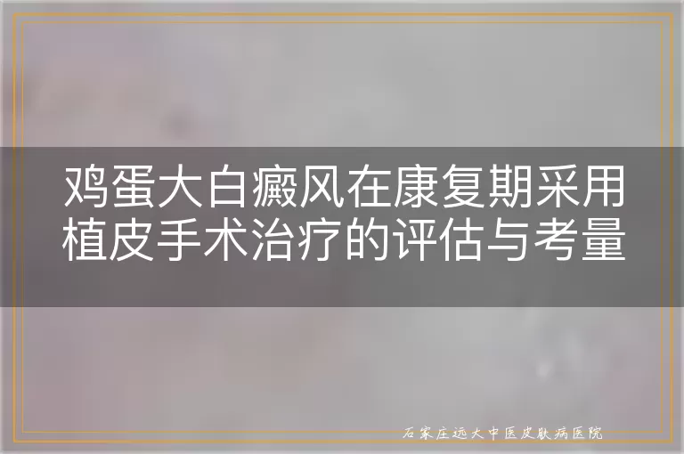 鸡蛋大白癜风在康复期采用植皮手术治疗的评估与考量