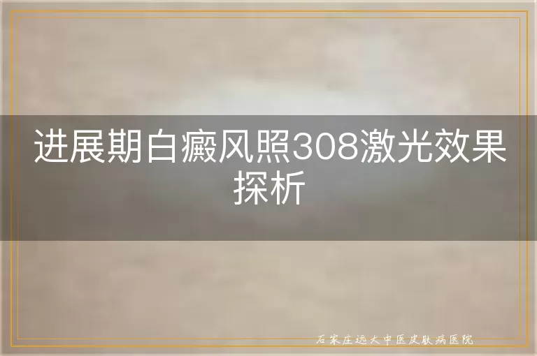 进展期白癜风照308激光效果探析