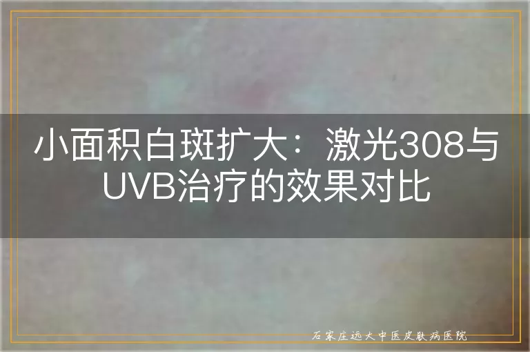 小面积白斑扩大：激光308与UVB治疗的效果对比