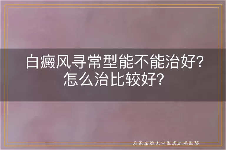 白癜风寻常型能不能治好？怎么治比较好？