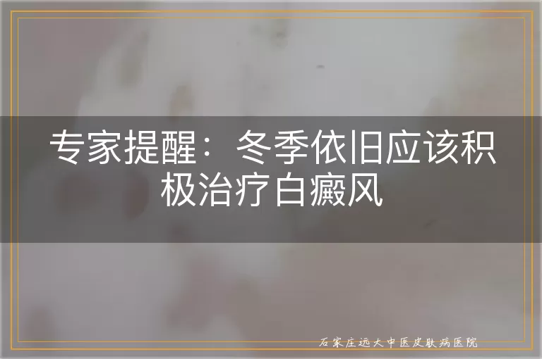 专家提醒：冬季依旧应该积极治疗白癜风