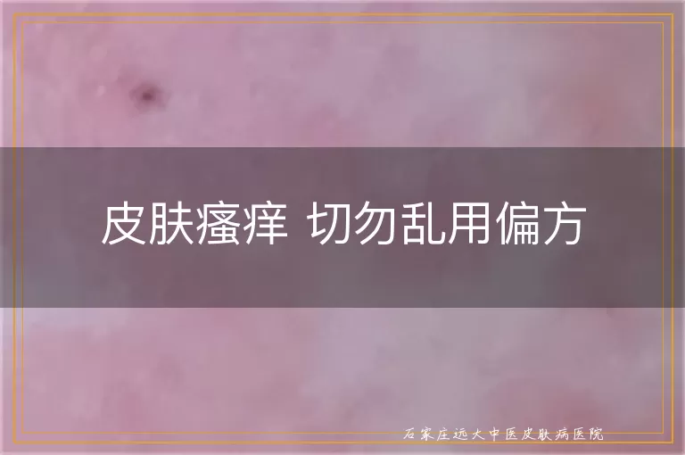 皮肤瘙痒 切勿乱用偏方