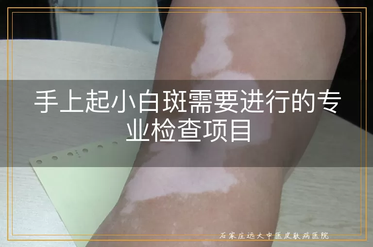 手上起小白斑需要进行的专业检查项目