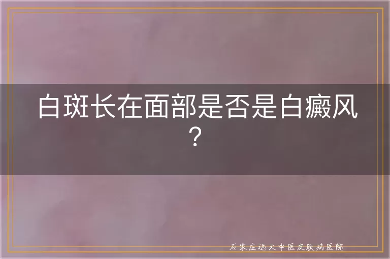 白斑长在面部是否是白癜风？