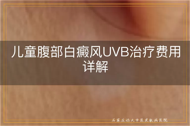 儿童腹部白癜风UVB治疗费用详解