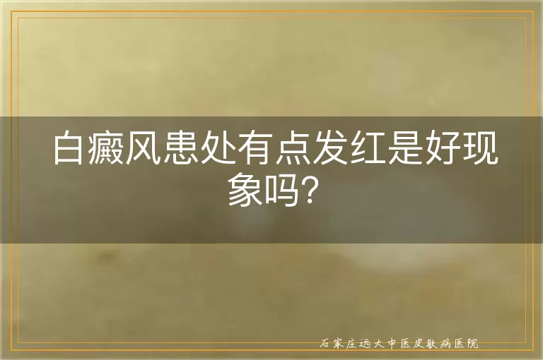 白癜风患处有点发红是好现象吗？