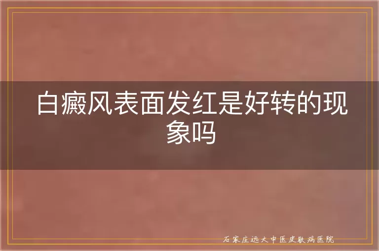 白癜风表面发红是好转的现象吗