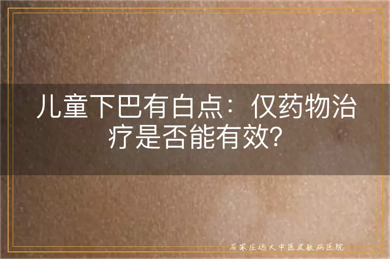 儿童下巴有白点：仅药物治疗是否能有效？