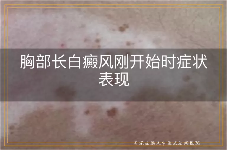 胸部长白癜风刚开始时症状表现