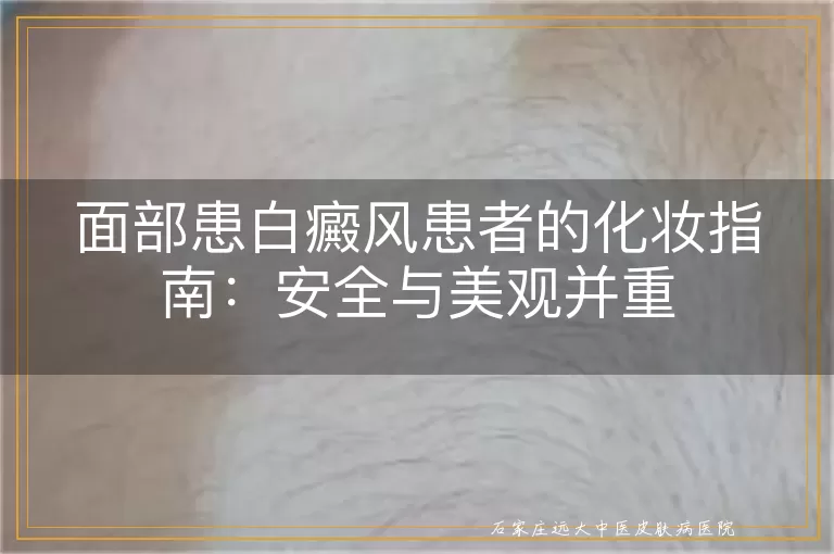 面部患白癜风患者的化妆指南：安全与美观并重