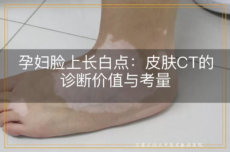 孕妇脸上长白点：皮肤CT的诊断价值与考量