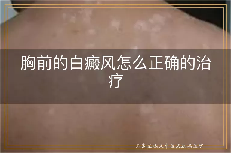 胸前的白癜风怎么正确的治疗