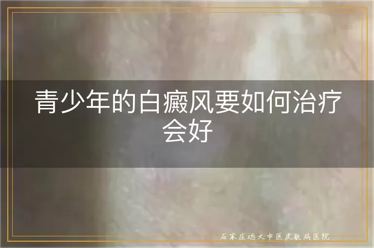 青少年的白癜风要如何治疗会好