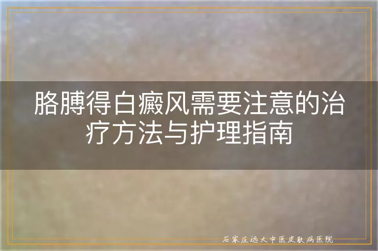 胳膊得白癜风需要注意的治疗方法与护理指南