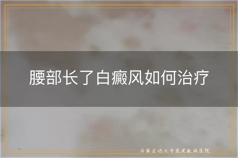 腰部长了白癜风如何治疗