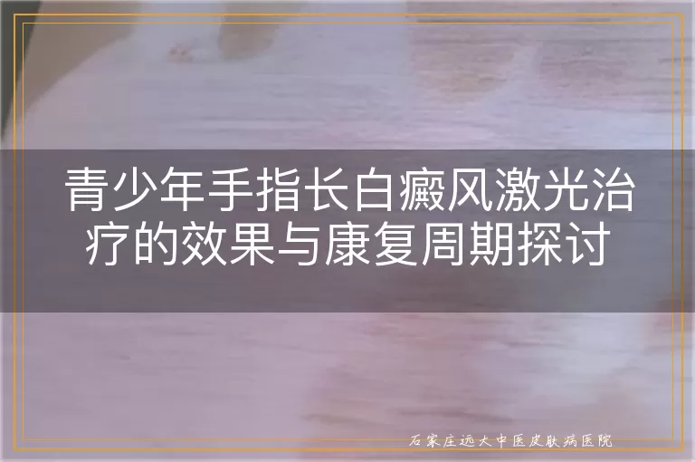 青少年手指长白癜风激光治疗的效果与康复周期探讨