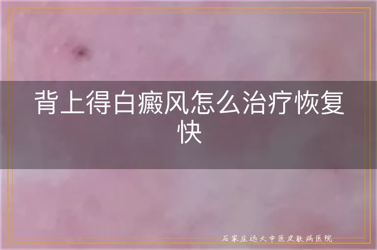 背上得白癜风怎么治疗恢复快