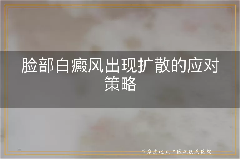 脸部白癜风出现扩散的应对策略