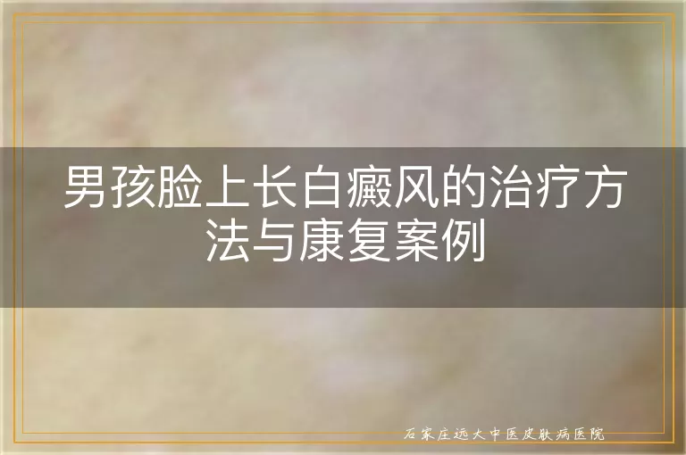 男孩脸上长白癜风的治疗方法与康复案例