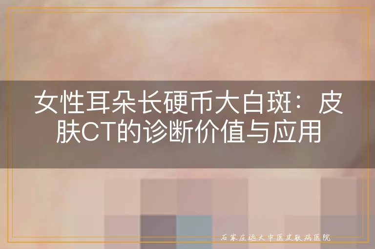 女性耳朵长硬币大白斑：皮肤CT的诊断价值与应用