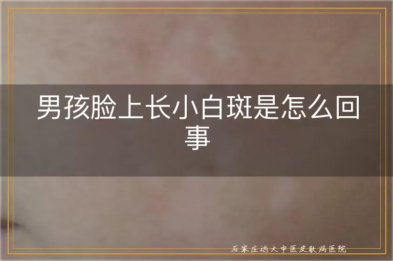 男孩脸上长小白斑是怎么回事