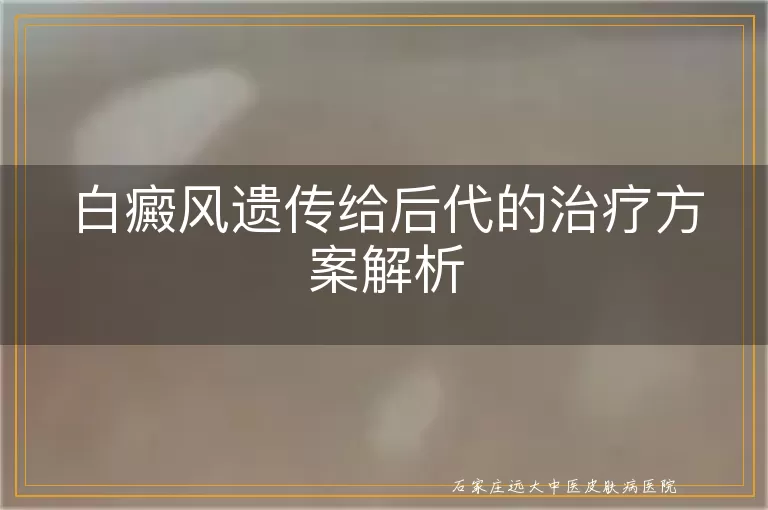 白癜风遗传给后代的治疗方案解析