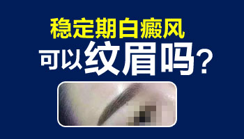 15岁男孩脸部长圆形白斑吃中药治疗需要多久能恢复好