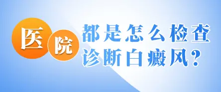 医院怎么检查诊断白癜风